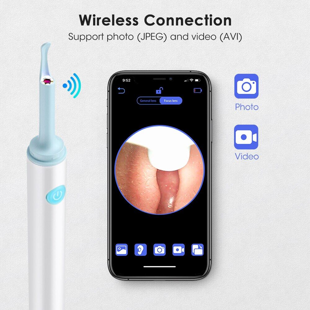 3.9mm WiFi Visual Ear Spoon 5.0MP Otoscope Camera Endoscope